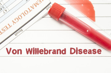Noi ghiduri privind diagnosticul și gestionarea bolii von Willebrand (VWD)