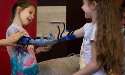 Proteze de mână personalizate, printate 3D, pentru copii