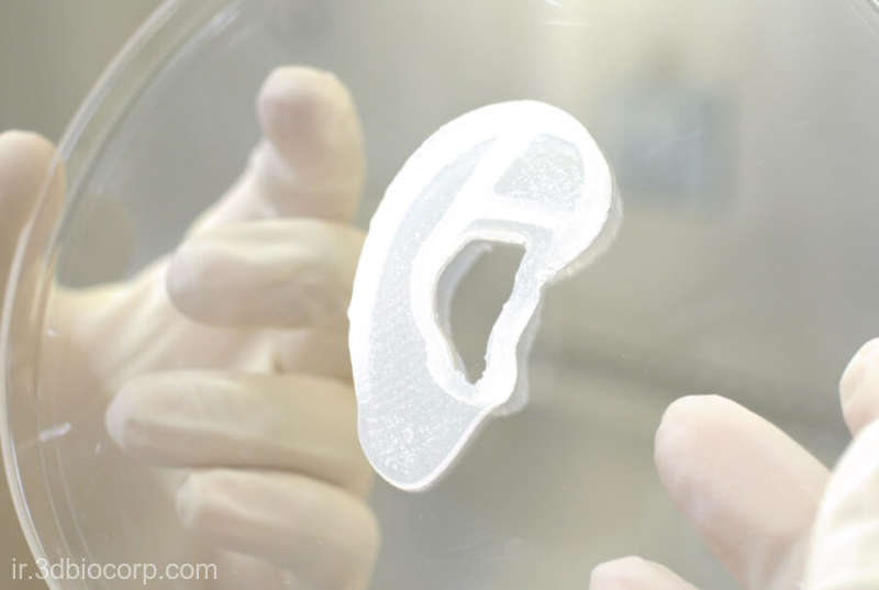 Implant de ureche imprimată 3D pe bază de celule umane, realizat în Statele Unite