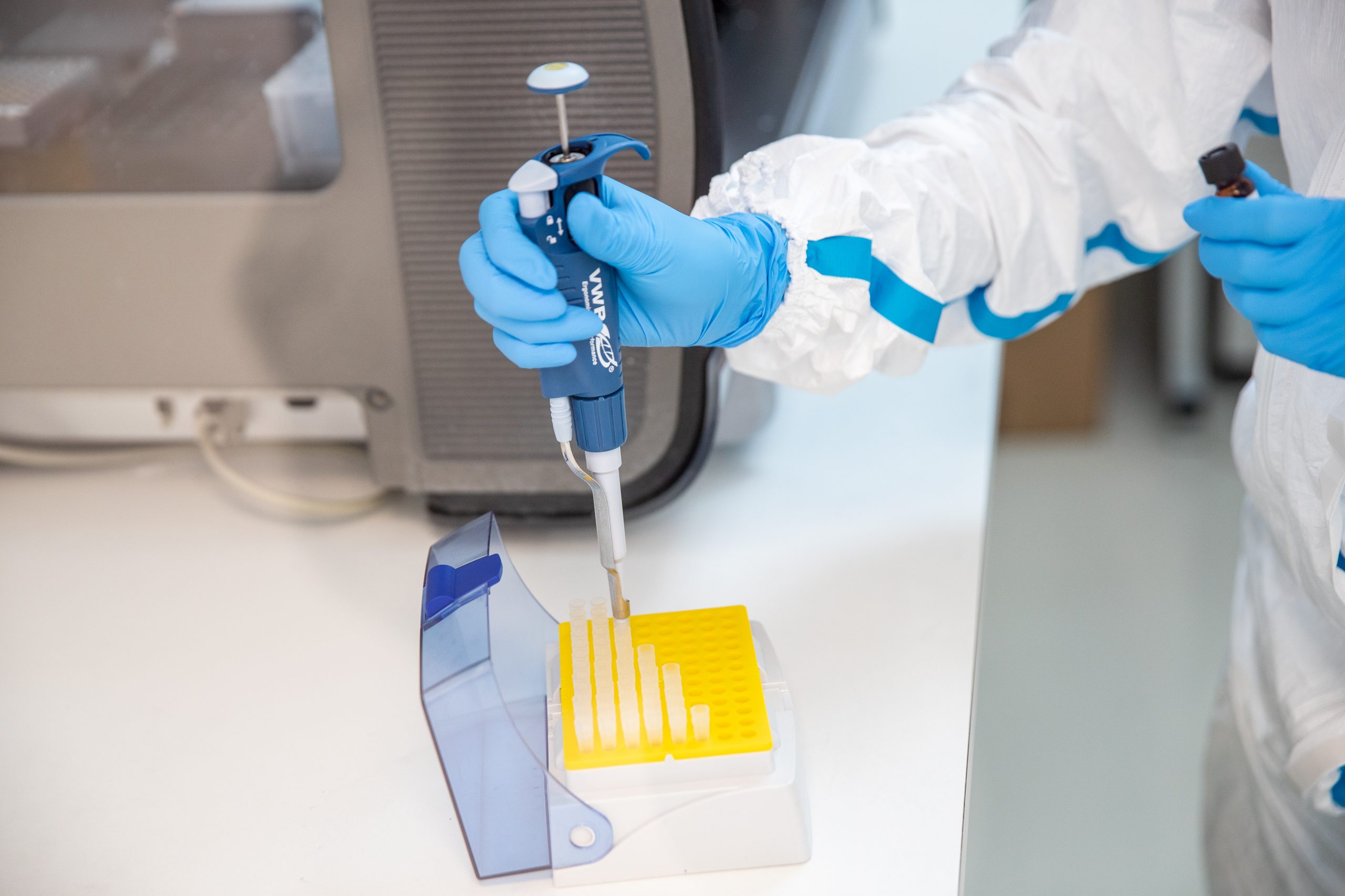 Testul de laborator pentru depistarea anticorpilor COVID-19, certificat CE, disponibil în România
