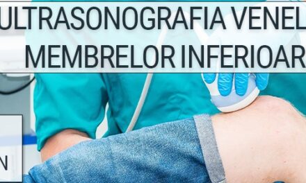 Webinar „Ultrasonografia venelor membrelor inferioare”