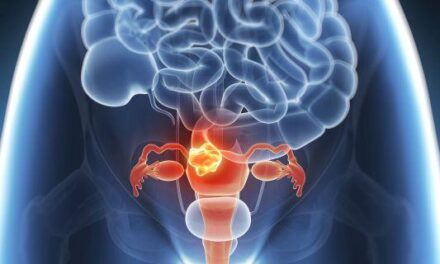 Femeile seropozitive prezintă un risc de 3,6 ori mai mare de a dezvolta cancer cervical