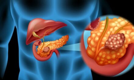 Legătura dintre cancerul de pancreas și cancerul de ficat