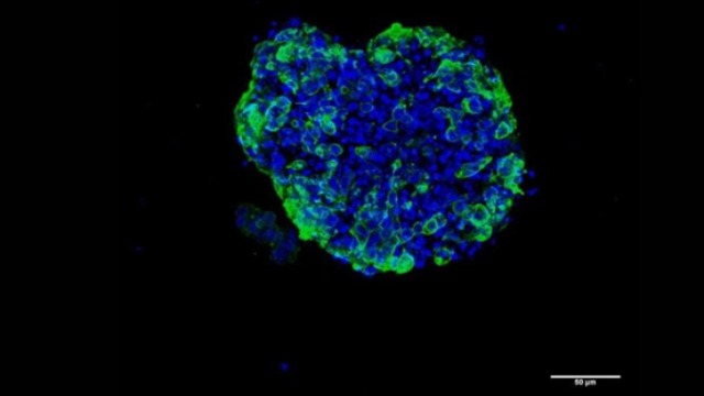 Primul studiu 3D epigenetic efectuat pe celule umane canceroase