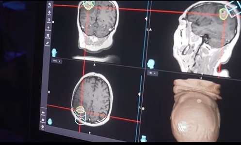România va beneficia de o reţea naţională de specialişti în tratarea pacienţilor cu traumatisme cranio-cerebrale