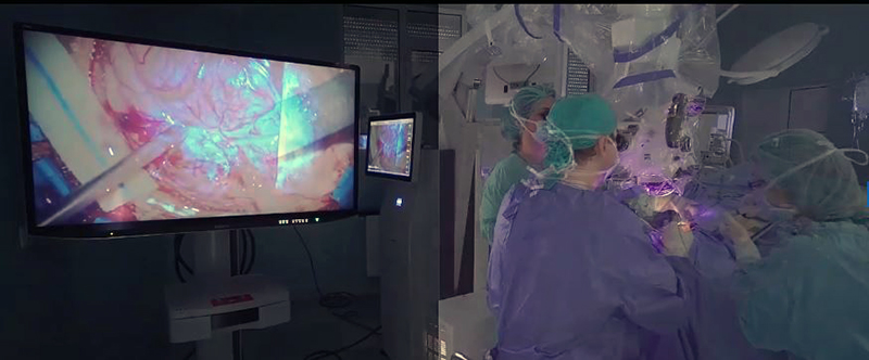 Intervenţie hi-tech pe creier la Spitalul de Neurochirurgie Iași