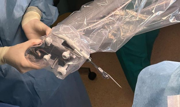 Prima implantare cohleară asistată robotic în România, realizată la Iași