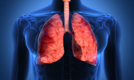Oamenii de știință de la IRB Barcelona identifică o potențială țintă pentru tratarea cancerului pulmonar