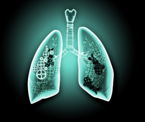 Progresia fibrozei pulmonare idiopatice poate fi analizată prin utilizarea unei platforme 3D