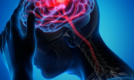 Oamenii de știință au identificat noi indicii genetice care ar putea trata accidentul vascular cerebral „silențios”