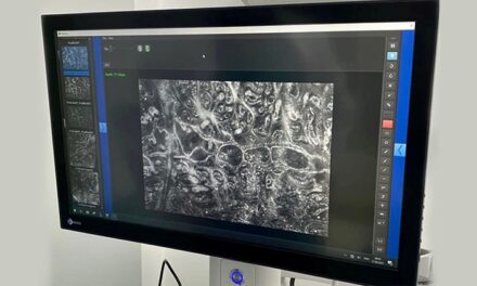 Spitalul de Boli Infecţioase din Galați a fost dotat cu un tomograf în coerenţă optică