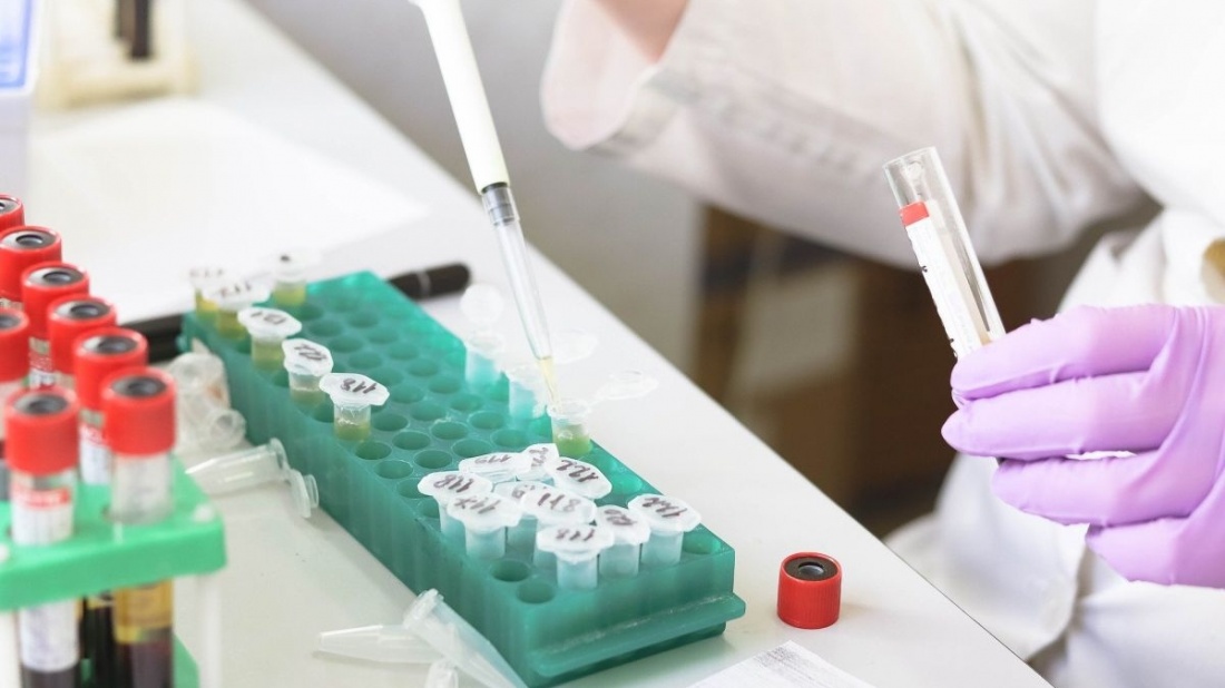 Unifarm a achizitionat testele PCR din Coreea de Sud direct, fara intermediari