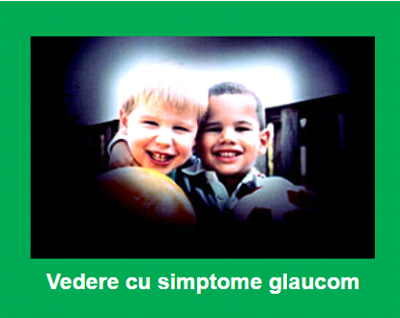 Societatea Română de Glaucom atrage atenția asupra bolii care orbește pe tăcute