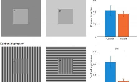 Depresia afectează percepţia vizuală (studiu)